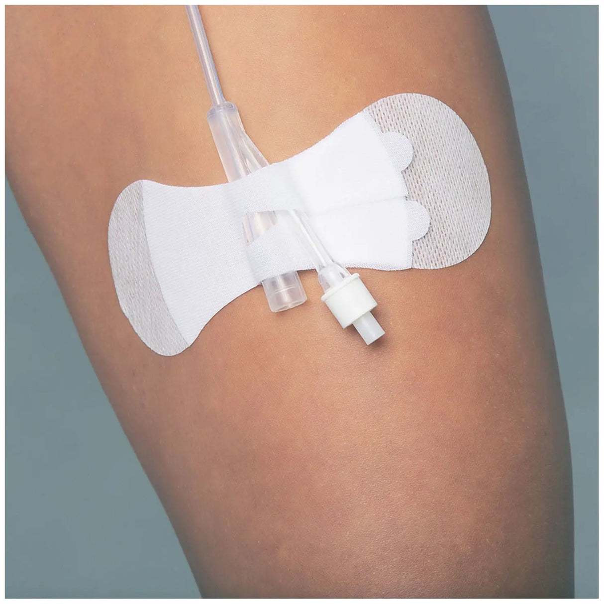 TIDI GRIP-LOK FOLEY SECUREMENT DEVICE - Universal Foley Large, Sterile, 100/bx TIDI Products, LLC