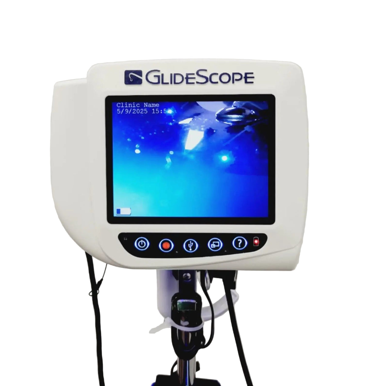 Verathon GlideScope Cobalt AVL Video Monitor with 2 Batons Warranty Verathon