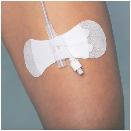 TIDI GRIP-LOK FOLEY SECUREMENT DEVICE - Universal Foley Large, Sterile, 100/bx TIDI Products, LLC