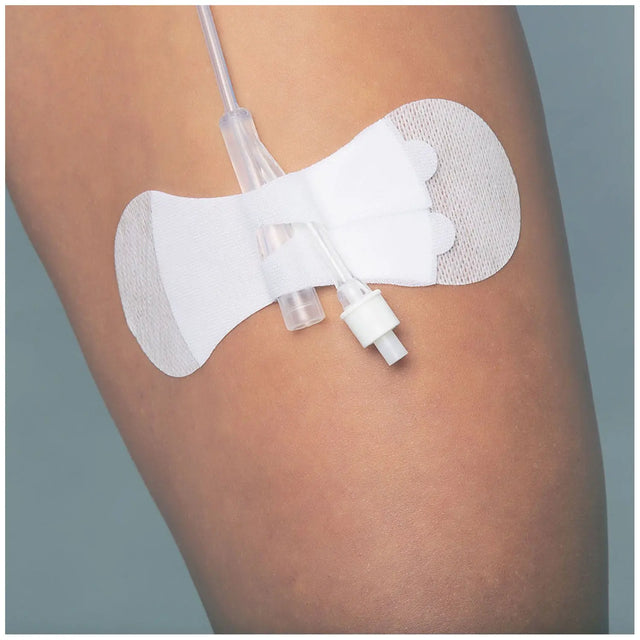 TIDI GRIP-LOK FOLEY SECUREMENT DEVICE - Universal Foley Large, Sterile, 100/bx TIDI Products, LLC